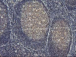 ASCC1 Antibody (clone OTI6G5)