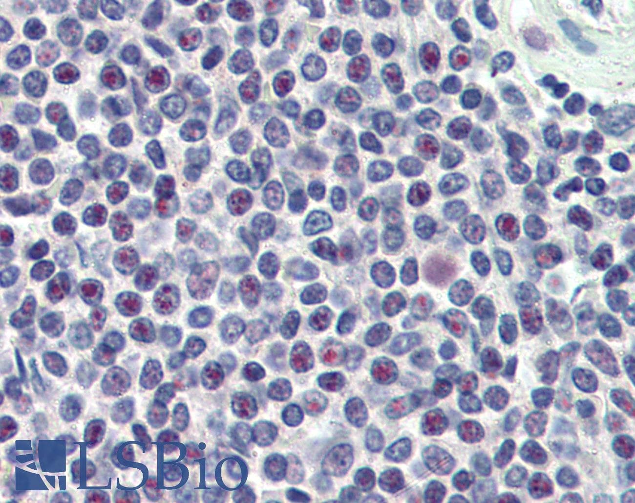 IHC-plus™ Polyclonal Goat anti-Human HMG20A Antibody (aa336-347, IHC, WB)