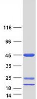 Human ASRGL1 Protein (Recombinant Myc-DDK (Flag))