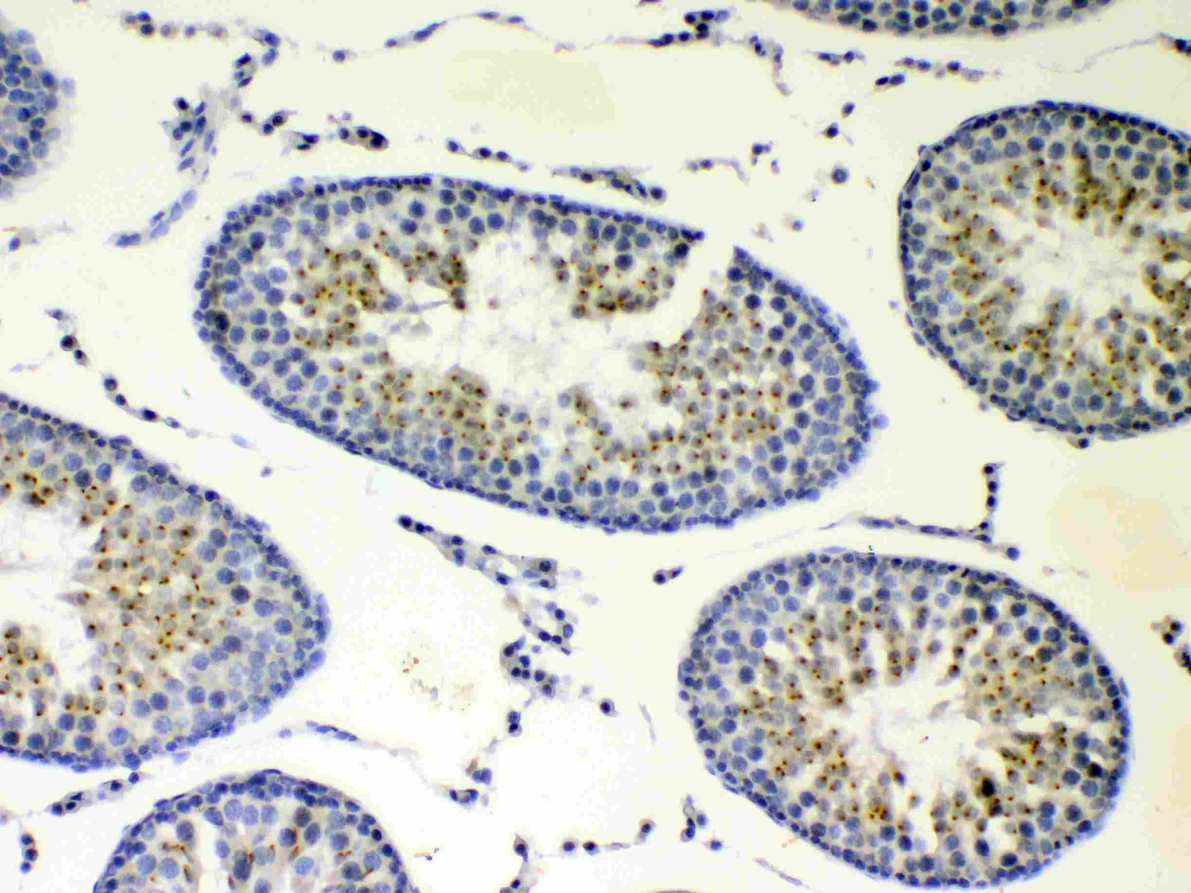 CCP110 Antibody