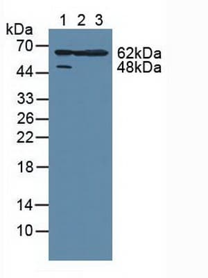 MAPKAPK2 / MAPKAP Kinase 2 Antibody (aa139-367)