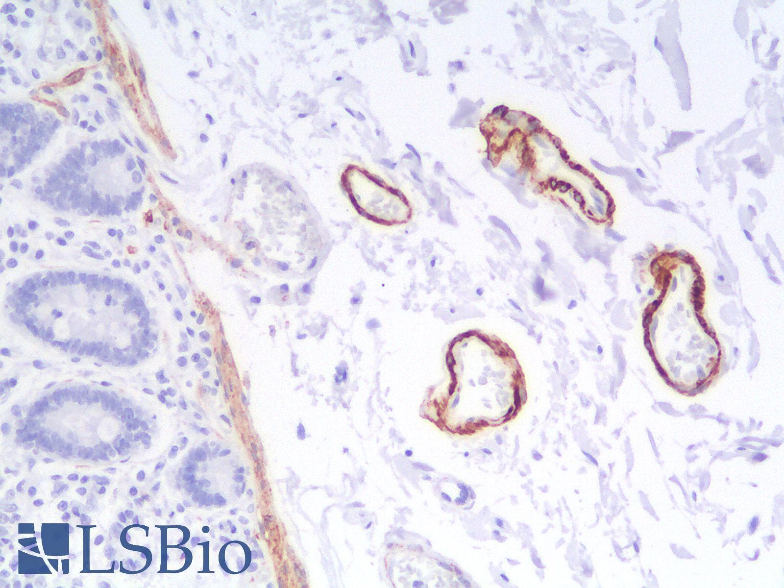 PathPlus™ SMMHC / MYH11 Antibody (clone MYH11/2303R)