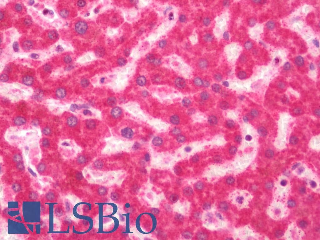 IHC-plus™ Polyclonal Rabbit anti-Human TWIK1 / KCNK1 Antibody (IHC, IF, WB)