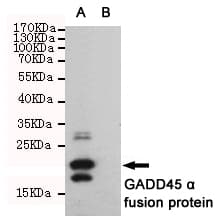 Monoclonal Mouse anti-Human GADD45A / GADD45 Antibody (WB)