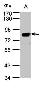 Beta Amyloid Antibody