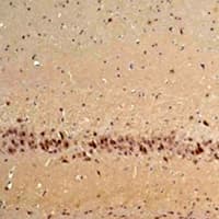 Polyclonal Rabbit anti-Mouse CABP / CABP1 Antibody (IHC, WB)