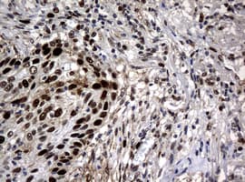 PCNA Antibody (clone OTI6B6)