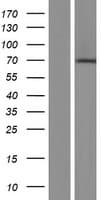 Human CNOT4 / CLONE243 Protein (Over-Expression Lysate Myc-DDK (Flag))