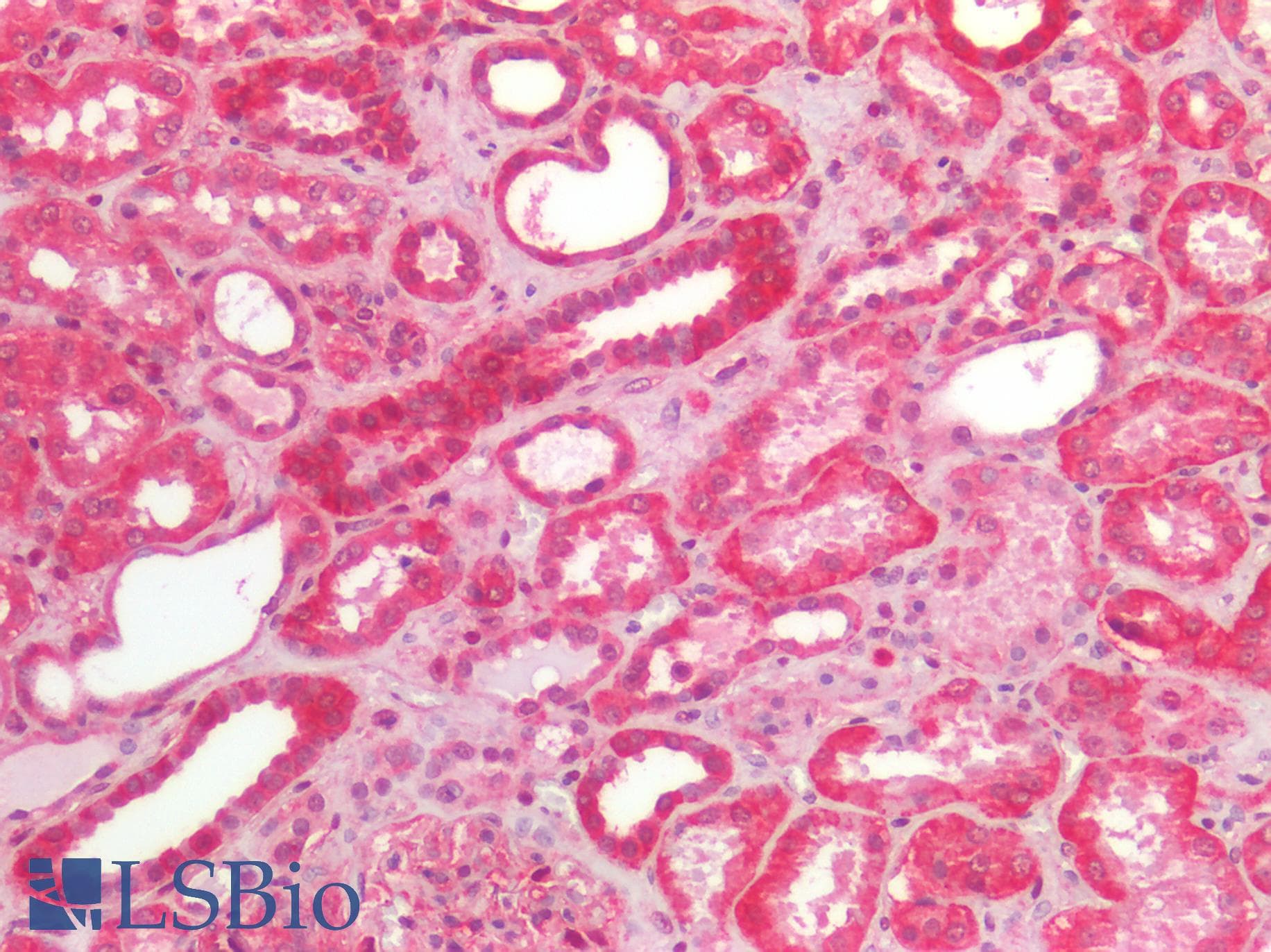 PathPlus™ Monoclonal Mouse anti-Human NDRG1 Antibody (clone 2D7, IHC, IF, WB)