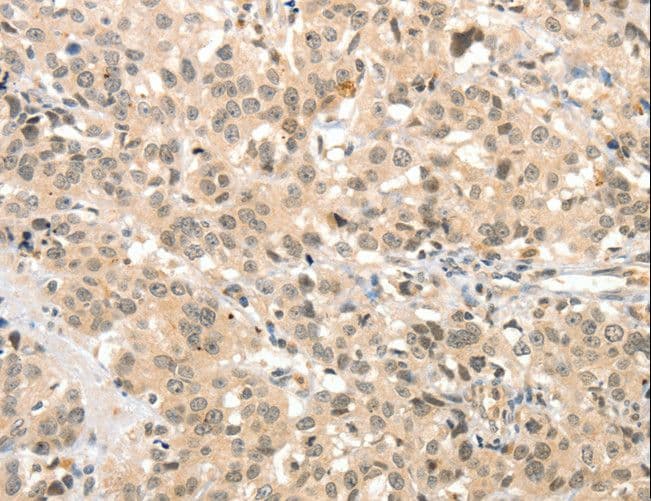 Polyclonal Rabbit anti-Human TSPYL2 / DENTT Antibody (IHC)