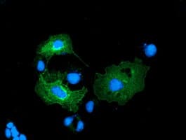 ERGIC-53 / LMAN1 Antibody (clone OTI1A8)