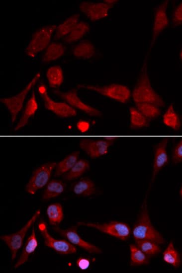 APBB1 / FE65 Antibody