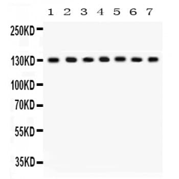 Polyclonal Rabbit anti-Human DLG1 / SAP97 Antibody (aa1-165, IHC, WB)