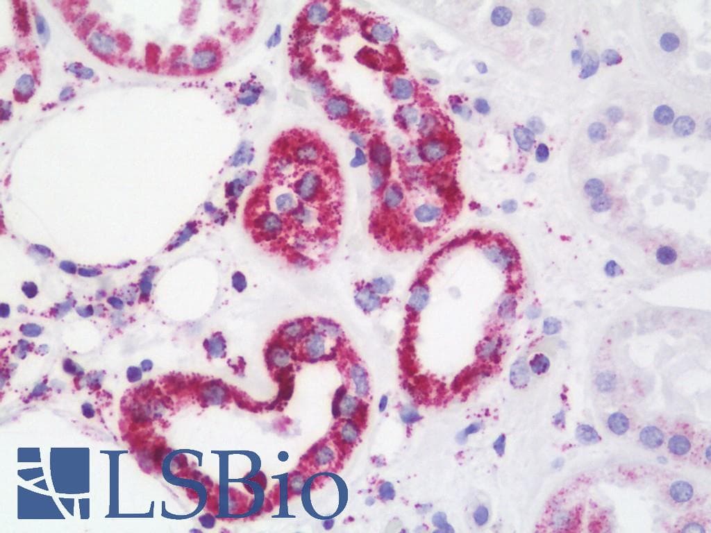 IHC-plus™ Polyclonal Rabbit anti-Human ATP5B / ATP Synthase Beta Antibody (aa135-163, IHC, WB)