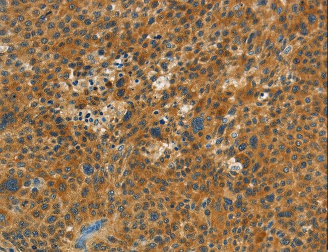 Polyclonal Rabbit anti-Human C15orf2 Antibody (IHC)