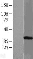 STARD7 Protein (Over-Expression Lysate Myc-DDK (Flag))