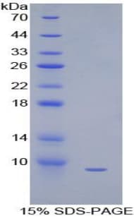 Human CCL3 / MIP-1-Alpha Protein (Recombinant His)