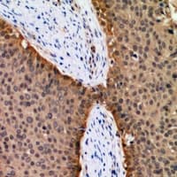 Polyclonal Rabbit anti-Human FOXO1 / FKHR Antibody (IHC, IF, WB)