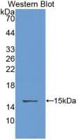 CSTB / Cystatin B / Stefin B Antibody (clone C13)