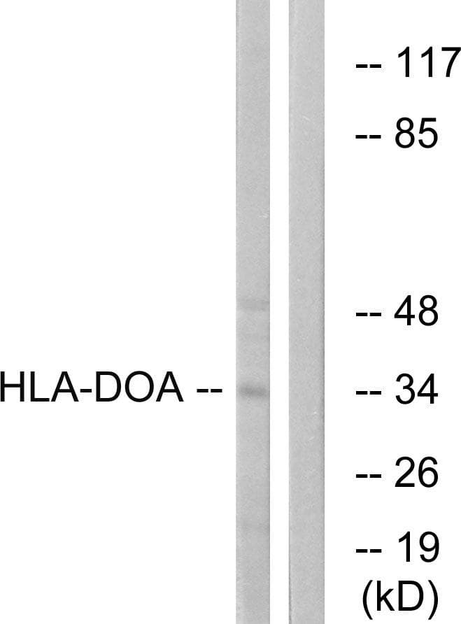 Polyclonal Rabbit anti-Human HLA-DOA Antibody (WB)
