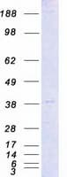 Human CDK7 Protein (Recombinant Myc-DDK (Flag))