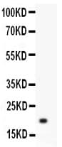 HSPB1 / HSP27 Antibody (aa1-205)
