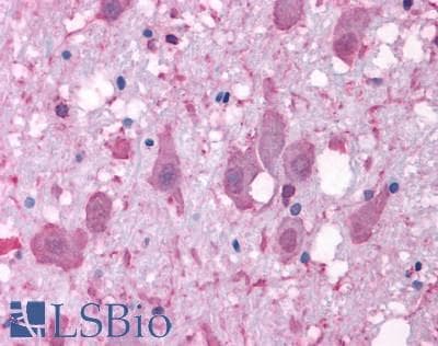 IHC-plus™ NPY2R Antibody (C-Terminus)