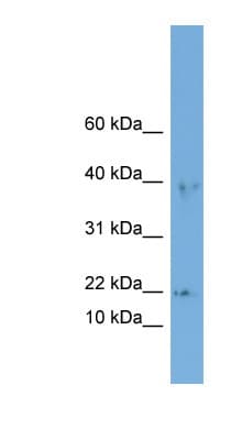 p21-ARC / ARPC3 Antibody (aa71-120)