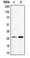 CD27L / CD70 Antibody (Internal)