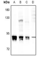 PRKCA / PKC-Alpha Antibody