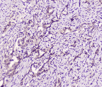 Polyclonal Rabbit anti-Human LATS1 Antibody (IHC, WB)