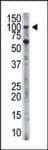 HK3 / Hexokinase 3 Antibody (aa760-789)