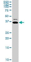 TNNT2 / CTNT Antibody (clone 3H4-F7)