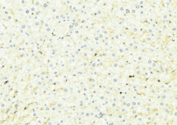 CHSY1 Antibody