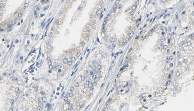 Polyclonal Rabbit anti-Human CEP170 Antibody (IHC, IF, WB)