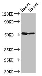 Polyclonal Rabbit anti-Human SHE Antibody (IHC, WB)