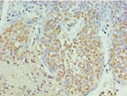 SEPT6 / Septin 6 Antibody (aa350-434)