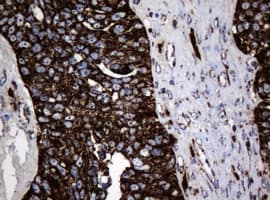 HSPD1 / HSP60 Antibody (clone OTI3G1)