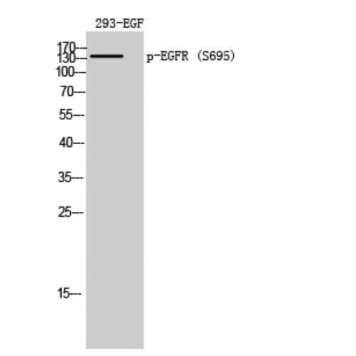 EGFR Antibody (630-710 aa)