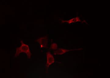 GLCNE / GNE Antibody