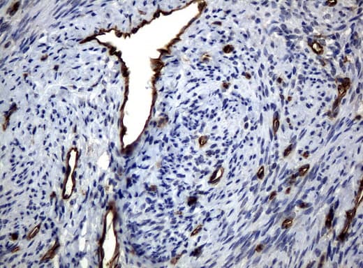 PECAM-1 / CD31 Antibody (clone UMAB29)