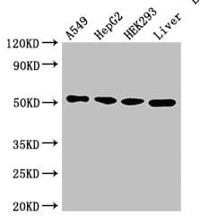 SLC16A7 / MCT2 Antibody