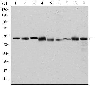Monoclonal Mouse anti-Human CCT2 / CCT Beta Antibody (clone 5B5C4, IF, WB)