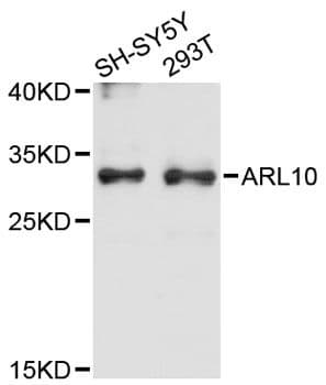 Polyclonal Rabbit anti-Human ARL10 Antibody (WB)