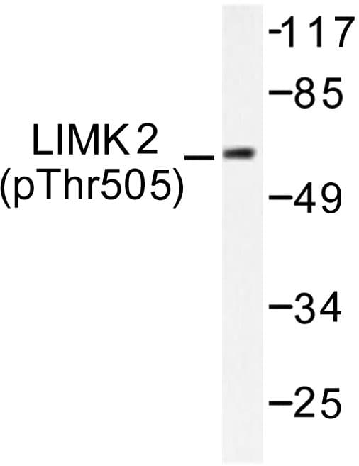 LIMK2 Antibody (phospho-Thr505)