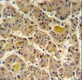 Polyclonal Rabbit anti-Human FLJ20309 Antibody (aa63-91, IHC, WB)