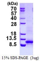 Mouse CXCL1 / GRO Alpha Protein (Recombinant His)