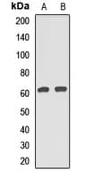 CHAF1B / CAF1 Antibody