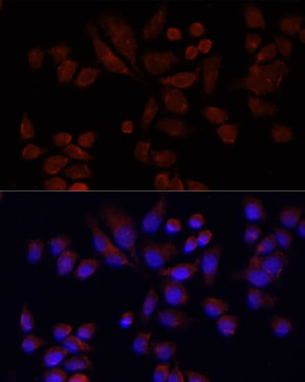 NAT2 Antibody