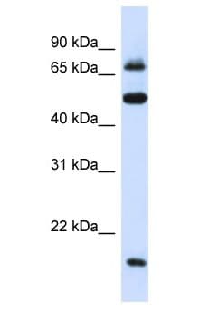 Polyclonal Rabbit anti-Human MED16 / THRAP5 Antibody (aa131-180, WB)